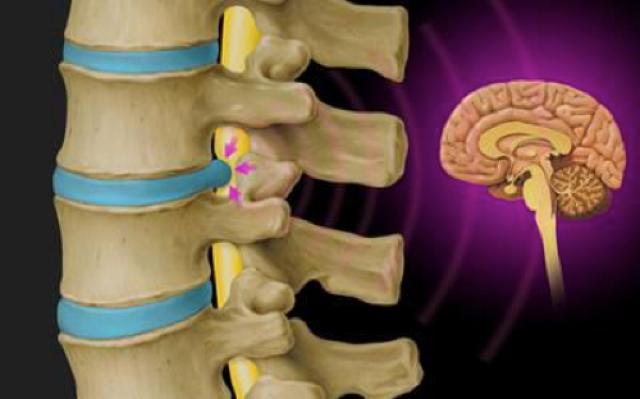 Rückenschmerzen - Was hilft bei Bandscheibenvorfall, Hexenschuss oder generellen Problemen mit der Wirbelsäule?